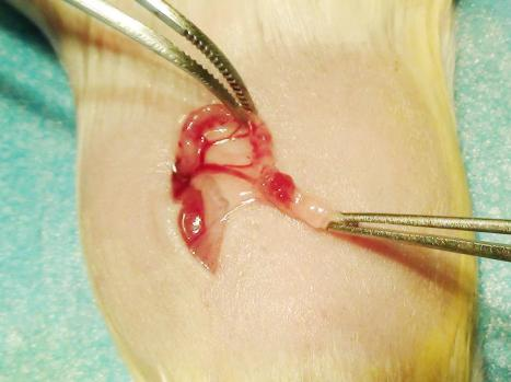 去卵巢致骨质疏松（Ovariectomy，OVX）模型