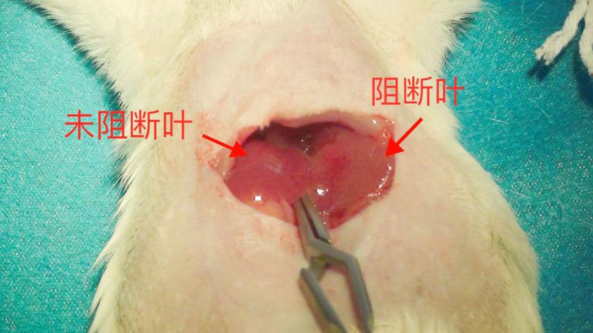 肝脏缺血再灌注（Hepatic Ischemia Reperfusion Injury, HIRI）模型