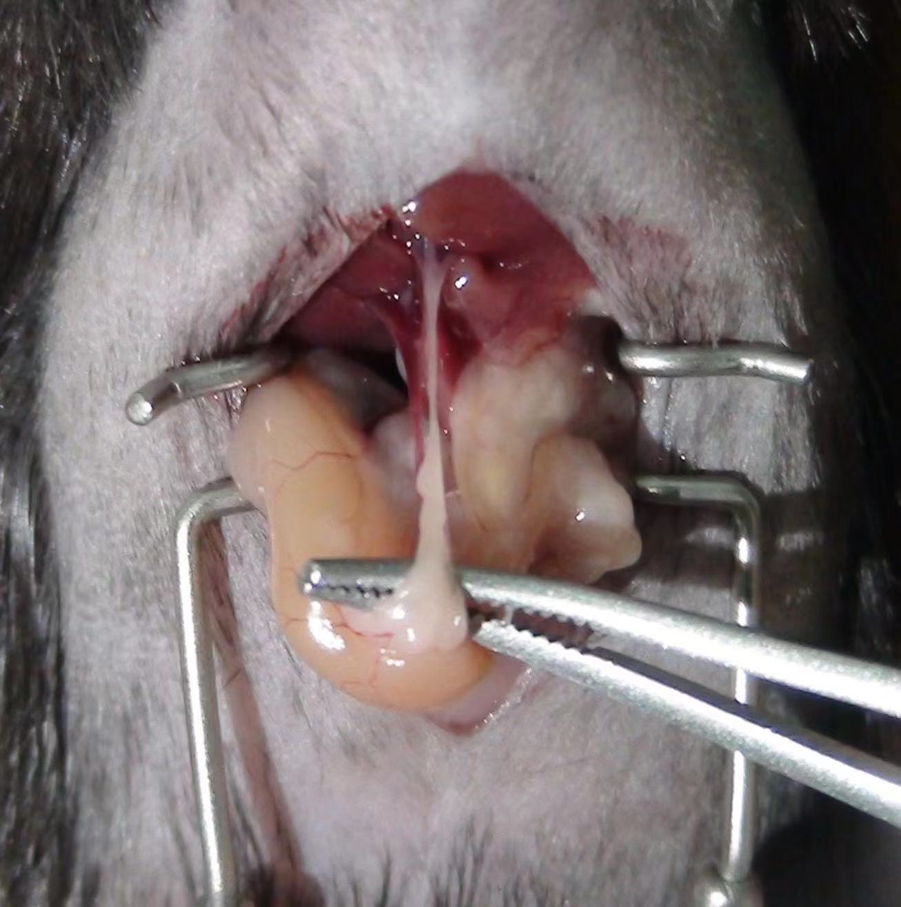 胆管结扎纤维化模型（Bile Duct Ligation，BDL）